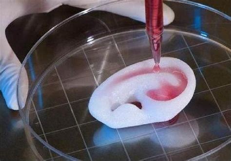 Zeta-Gelatin:  Revolutionizing Medical Implants and Tissue Engineering